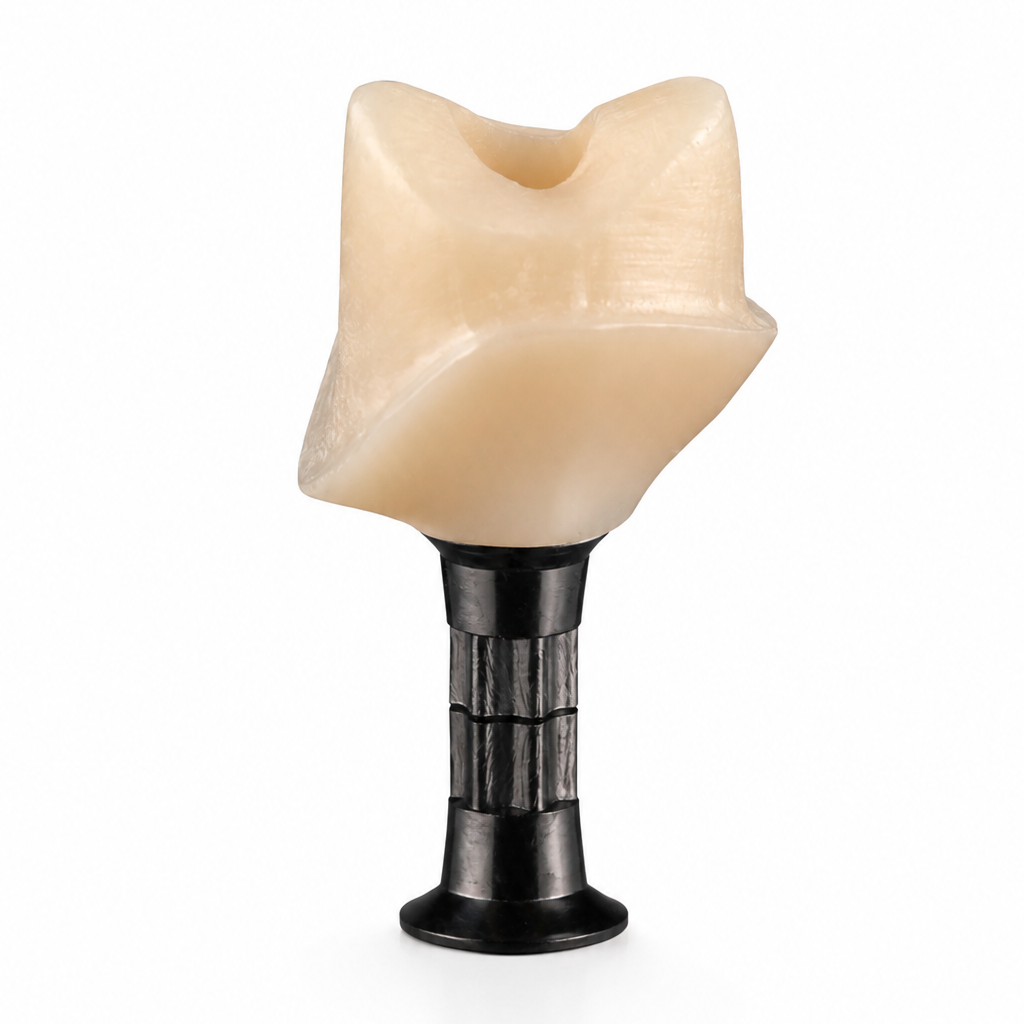 Abutment